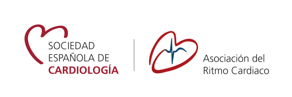 SEC - RITMO CARDIACO